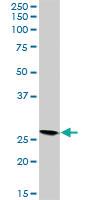 Anti-VAPB Rabbit Polyclonal Antibody