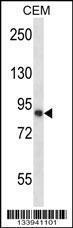 Anti-CAPN11 Rabbit Polyclonal Antibody (FITC (Fluorescein Isothiocyanate))