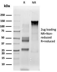 Anti-ETS2 antibody