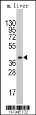 Anti-CD8B Rabbit Polyclonal Antibody