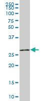 Anti-UNG Mouse Polyclonal Antibody