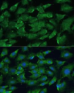 Immunofluorescence analysis of C6 cells using Anti-SHP2 Antibody (A93012) at a dilution of 1:100. DAPI was used to stain the cell nuclei (blue)