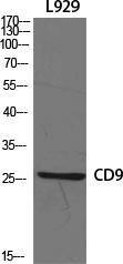 Western blot analysis of various cells using Anti-CD9 Antibody