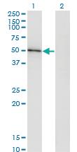 Anti-HAVCR1 Mouse Monoclonal Antibody [clone: 2G11]