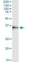 Anti-SNX11 Antibody Pair