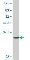 Anti-KCNE2 Mouse Polyclonal Antibody