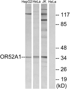 Western blot analysis of lysates from HeLa, Jurkat, and HepG2 cells using Anti-OR52A1 Antibody. The right hand lane represents a negative control, where the antibody is blocked by the immunising peptide