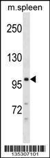 Anti-DSC3 Rabbit Polyclonal Antibody (HRP (Horseradish Peroxidase))