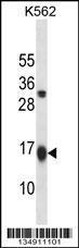 Anti-GABARAPL2 Rabbit Polyclonal Antibody (AP (Alkaline Phosphatase))