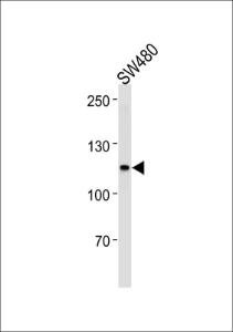 Anti-MSH2 Rabbit Polyclonal Antibody (FITC (Fluorescein Isothiocyanate))