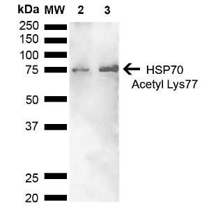 Western blot analysis of human Cervical cancer cell line (HeLa) lysate showing detection of ~70 kDa HSP70 Acetyl Lys77 protein using Anti-HSP70 (Acetyl Lys77) Antibody (A305054) at 1:1,000 for 2 hours at room temperature