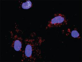 Anti-AKT1 + SRC Antibody Pair