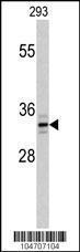 Anti-PPT1 Rabbit Polyclonal Antibody (PE (Phycoerythrin))