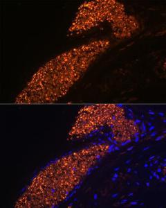 Immunofluorescence analysis of human placenta using Anti-fetal hemoglobin Antibody [ARC1837] (A309083) at a dilution of 1:100 (40x lens). DAPI was used to stain the cell nuclei (blue).