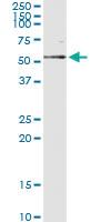 Anti-PTEN Mouse Monoclonal Antibody [clone: 1C3]