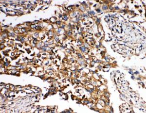 Anti-SMAD5 Rabbit Polyclonal Antibody