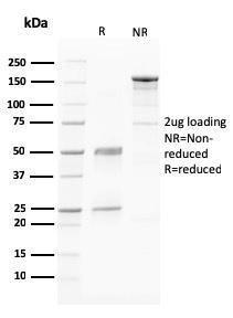 Anti-PAPP A antibody