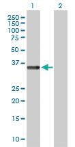 Anti-STEAP1 Rabbit Polyclonal Antibody