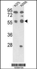 Anti-TFPI2 Rabbit Polyclonal Antibody (AP (Alkaline Phosphatase))