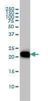 Anti-RHOA Mouse Monoclonal Antibody [clone: 1B12]