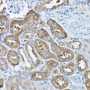 Immunohistochemistry analysis of paraffin-embedded mouse kidney using Anti-Nesprin1/Syne-1 Antibody (A306171) at a dilution of 1:100 (40X lens). Perform high pressure antigen retrieval with 10 mM citrate buffer pH 6.0 before commencing with IHC staining protocol