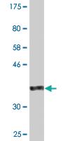 Anti-KAT6A Mouse Monoclonal Antibody [clone: 4D8]