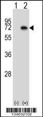 Anti-MAP3K7 Rabbit Polyclonal Antibody (Biotin)