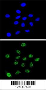 Anti-DKC1 Rabbit Polyclonal Antibody (HRP (Horseradish Peroxidase))