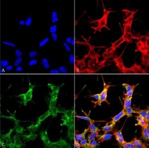 Immunocytochemistry/Immunofluorescence analysis of human embryonic kidney cells (HEK293) cultured overnight with 50 µM H2O2, fixed in 5% formaldehyde for 5 minutes, using Anti-HSP70 (Acetyl Lys77) Antibody (A305054), at 1:60 for 30-60 min at room temperature