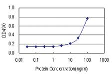 Anti-CENPP Antibody Pair