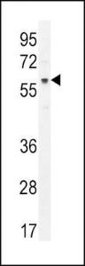 Anti-AKT1 Rabbit Polyclonal Antibody (AP (Alkaline Phosphatase))