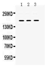 Anti-PDGFRA Rabbit Polyclonal Antibody