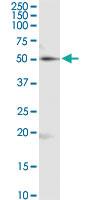 Anti-RUVBL2 Mouse Monoclonal Antibody [clone: 3C6]