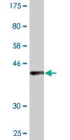 Anti-UVRAG Mouse Monoclonal Antibody [clone: 2E8]