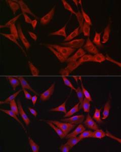 Immunofluorescence analysis of NIH/3T3 cells using Anti-RASGRP1 Antibody (A8633) at a dilution of 1:100 (40X lens). DAPI was used to stain the cell nuclei (blue)