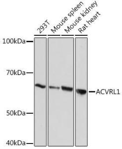 Anti-ALK-1 Rabbit Monoclonal Antibody [clone: ARC1735]