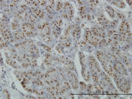 Anti-MGAT4A Mouse Monoclonal Antibody [clone: 4H4]