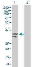 Anti-UNG Rabbit Polyclonal Antibody