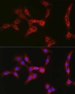 Immunofluorescence analysis of NIH/3T3 cells using Anti-Nesprin1/Syne-1 Antibody (A306171) at a dilution of 1:100 (40X lens). DAPI was used to stain the cell nuclei (blue)