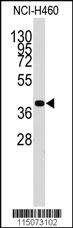 Anti-LECT1 Rabbit Polyclonal Antibody