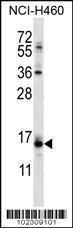 Anti-RCAN2 Rabbit Polyclonal Antibody (APC (Allophycocyanin))