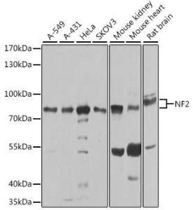 Antibody anti-NF2 100 µl