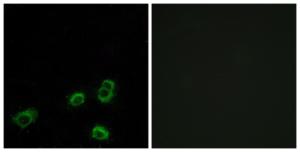 Immunofluorescence analysis of MCF7 cells using Anti-OR52A1 Antibody. The right hand panel represents a negative control, where the antibody was pre-incubated with the immunising peptide