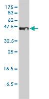 Anti-STEAP1 Mouse Monoclonal Antibody [clone: 4F6-1F3]