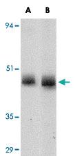 Anti-CD4 Mouse Monoclonal Antibody [clone: 8G1B12]