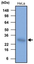 Anti-HSPB1 Mouse Monoclonal Antibody [clone: 2A5]