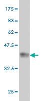 Anti-BAAT Mouse Monoclonal Antibody [clone: 5B6]