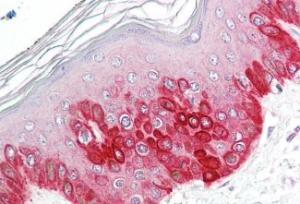 Anti-ATG16L1 Antibody (A83310) (3.75µg/ml) staining of paraffin embedded Human Skin. Steamed antigen retrieval with citrate buffer pH 6, AP-staining.