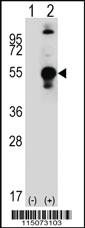 Anti-LECT1 Rabbit Polyclonal Antibody