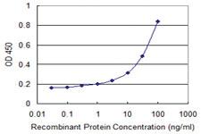 Anti-TNRC6B Mouse Monoclonal Antibody [clone: 3G11]